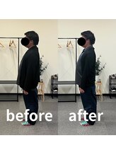 熊本カワル整体 JR上熊本駅院/肩・首の痛み