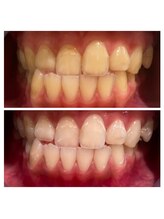 ルフレ(Reflet)/1回の変化☆S30→S14