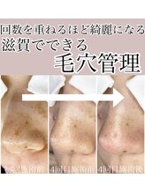 プリュム(Plume)/滋賀でできる肌管理