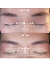 クリル(Kuril)/ビフォーアフター30代女性♪