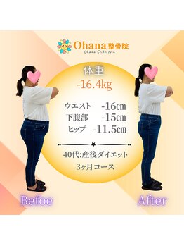 オハナ整骨院(Ohana整骨院)の写真/DNA検査で体質を知り、分子栄養学ダイエットと美容整体で理想の体に！　90日で－6キロ以上を目指す！