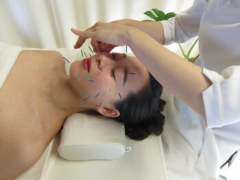 登美ヶ丘治療院の写真/【“美容鍼“小顔効果・むくみ解消◎】(翡翠ローラー/中医学式鍼灸+全身マッサージ/八宝茶)付き♪