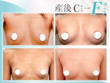 美人バスト　川越店の雰囲気（産後バストも3カップUP続出！デコルテ削げもお任せください♪）