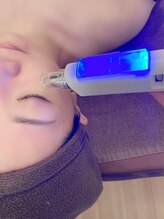 クラウドナインエステティック(Cloud Nine esthetic)