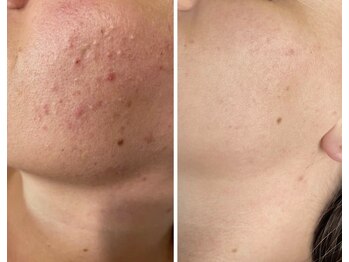 ヴィテラス バイ アリア(Veteras by aria)/☆当店でNO.1メニュー☆