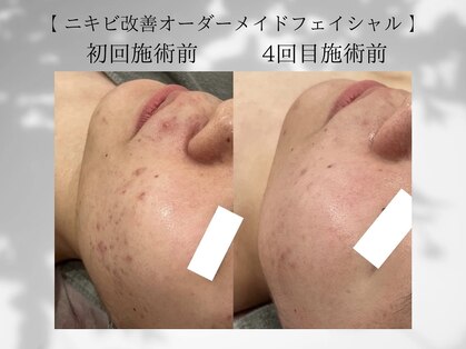 リライン(ReLine)の写真