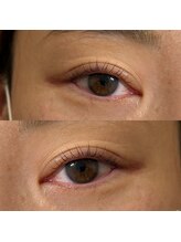 ミミシル 三条店(mimicil)/ラッシュリフト