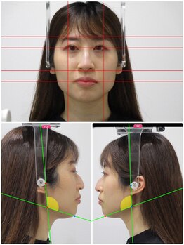 顔と身体の歪み矯正院 吉祥寺/小顔矯正/エラ張り改善