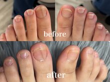 爪のいろは/足爪のイメチェンしませんか？