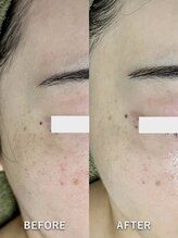 サロンドジェシカ(salon de Jessica)/プラズマ