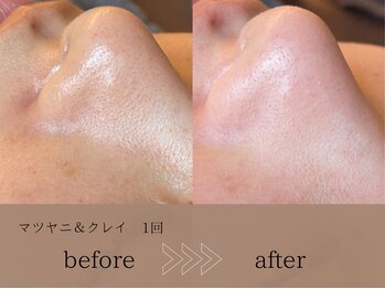 ヴィーヴォ(Vivo)/マツヤニ&クレイ