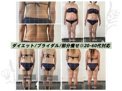 ボディメイクサロンアプローズの写真