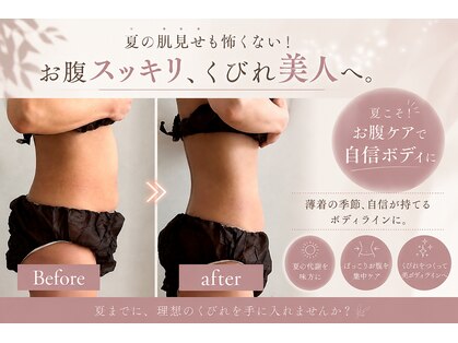 スリラ(SuriLa)の写真