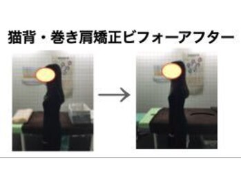 やち鍼灸院/猫背・巻き肩矯正も！