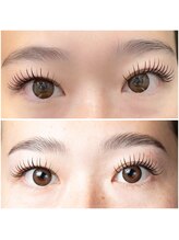 アイル(eye'll)/Hollywood　brow lift