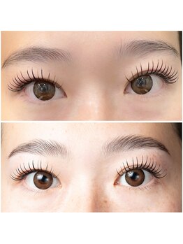 アイル(eye'll)/Hollywood　brow lift