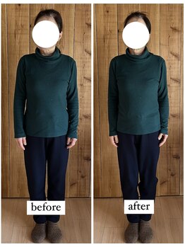 マーマー(murmur.)/骨盤矯正 before / after