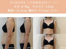 エターナルフレーム(Eternal Flame)/47歳上半身二の腕集中痩身スリム