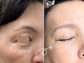 レディゴー(LADY GO)/上がり眉から平行眉へ