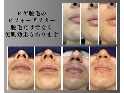 ボゴス(BOGOSS)の写真