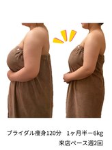 コーラル(Coral)/ブライダル痩身（施術結果）