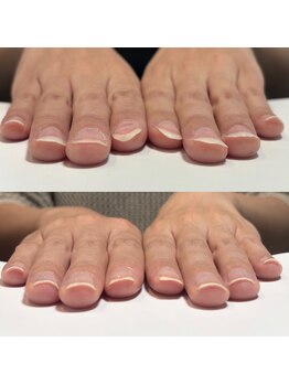 ルクレール カシェット(Le clair cachette)/美爪育成コース