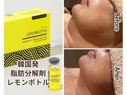 ベルフィーヌ ノーブル(BELLEFINE noble)の写真