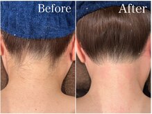 ジョエルワックス 沖縄那覇店(JOELLE WAX)/うなじ脱毛！新規★