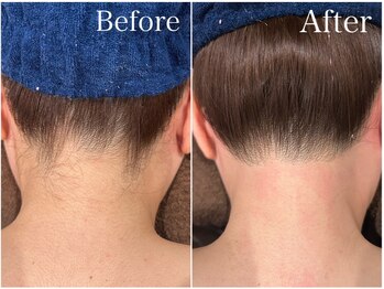 ジョエルワックス 沖縄那覇店(JOELLE WAX)/うなじ脱毛！新規★