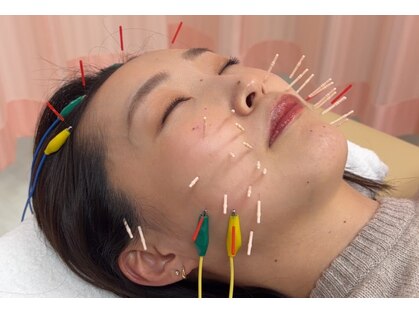 木下美容鍼灸整骨院の写真