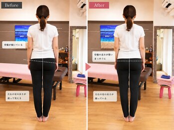 ボディステップ(BODY STEP)/整体で叶える大人のシルエット