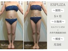 エスプライザ 横浜綱島店(ESPLIZA)の雰囲気（結果重視！お悩みに合わせてお施術いたします♪）