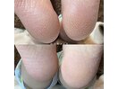 ◇フット角質ケア◇