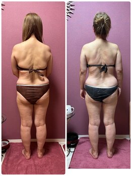 ビマリア(美-MARIA)/美BODY痩身リンパ　60代のお客様