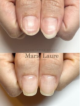 マリーロール 梅田店(Marie Laure)/深爪矯正/自爪育成/自爪風