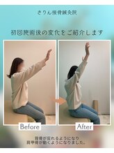 きりん接骨鍼灸院 尼崎武庫之荘店/手が挙げやすくなりました♪