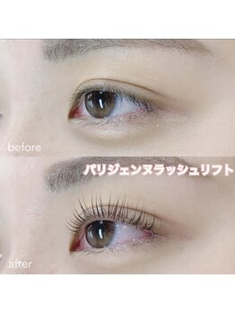 レディエント(Radiant)/パリジェンヌラッシュリフト