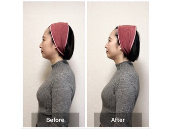 ラニ(Lani)/小顔美人整顔