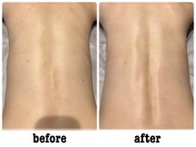 グランディール 仙台広瀬通り店(Grandir)/-背骨リリース-