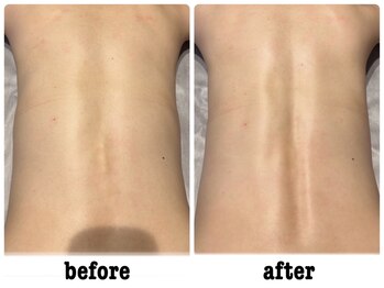 グランディール 仙台広瀬通り店(Grandir)/-背骨リリース-