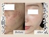 【シミ・毛穴】一掃！ハリ艶・透明感アップ美白Facial　75分 ¥16500⇒¥13000