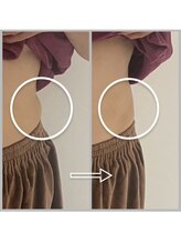 エステサロンパリス(Esthe Salon Paris)/60代の女性　お腹スッキリ