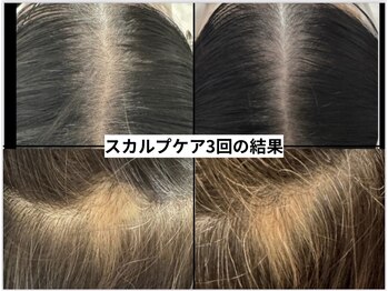 リアリア(LEALEA)/スカルプケア