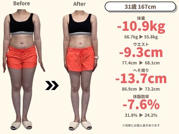 ニドム/31歳　-10kg産後痩身ダイエット1