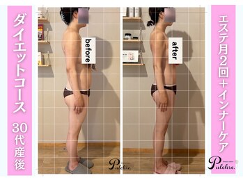 プルクレ 常磐町店(Pulchre)/30代産後ダイエットコース♪