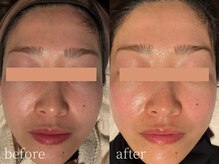 コモレビ(komorebi)/くすみ改善トーンアップ♪