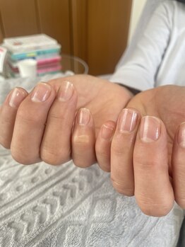 エクラプラス(Eclat.plus)/自爪育生ケア