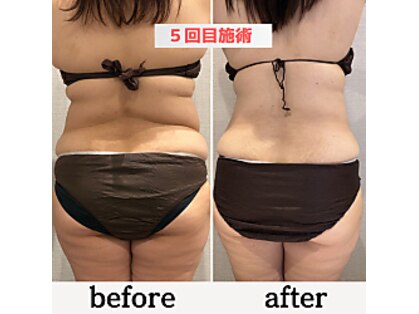 ケーブロッサムビューティーサロン(K Blossom Beauty Salon)の写真