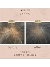 ココ 2号店(CoCo)/頭皮環境改善/スカルプ棘ケア