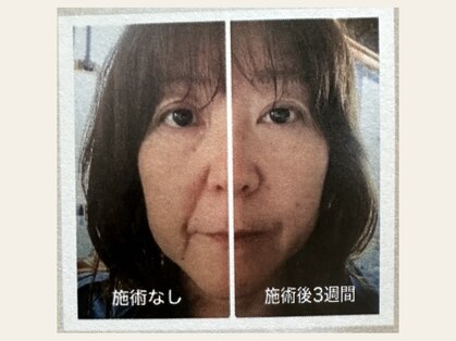 ジュビル(JUBIL)の写真